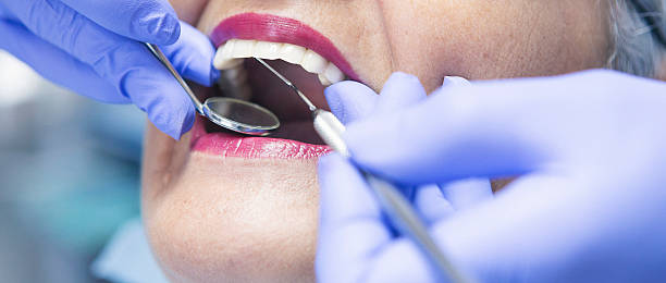 Best Emergency Treatment for Dental Infections or Abscesses in Parkville, MO
